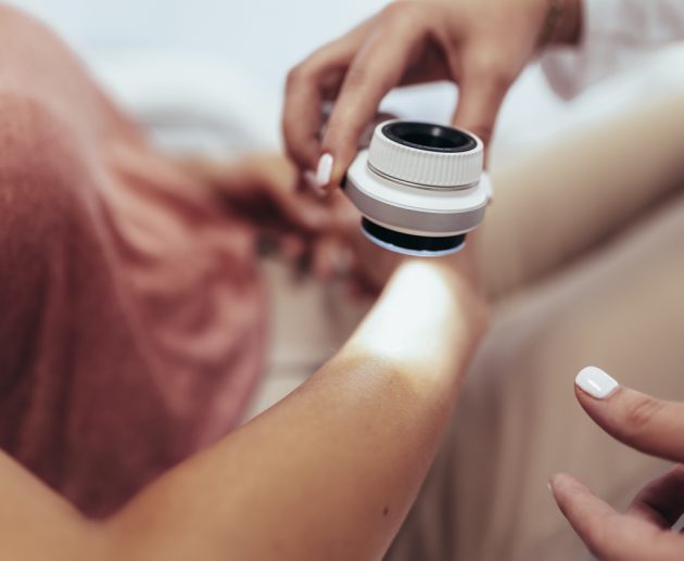 The dermatologist examines the moles or acne of the patient with a dermatoscope. Prevention of melanoma