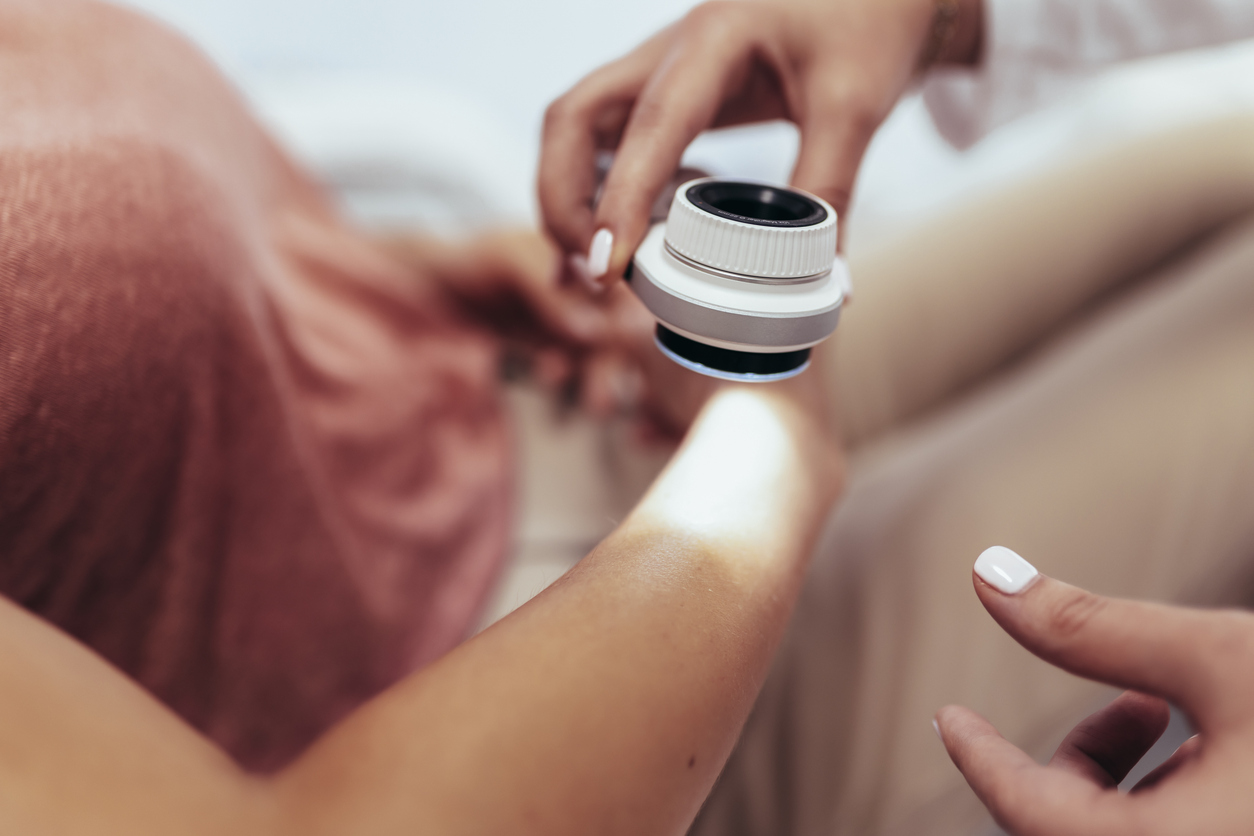 The dermatologist examines the moles or acne of the patient with a dermatoscope. Prevention of melanoma